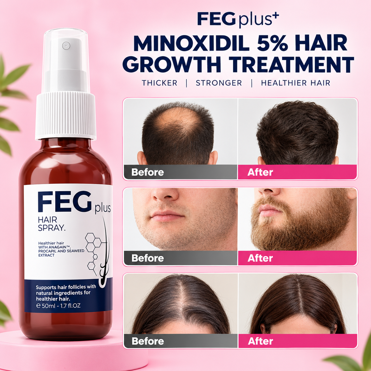 FEG Hair Growth Spray