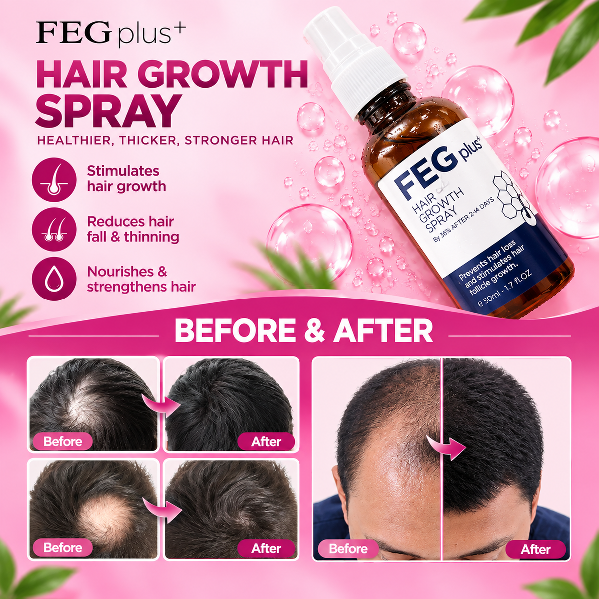 FEG Hair Growth Spray