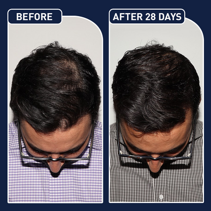 FEG Hair Growth Spray